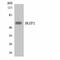 IKAROS Family Zinc Finger 2 antibody, A05228-1, Boster Biological Technology, Western Blot image 