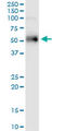 ETS Variant 1 antibody, LS-C197163, Lifespan Biosciences, Western Blot image 