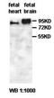 Tigger Transposable Element Derived 5 antibody, orb77614, Biorbyt, Western Blot image 