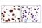 PDZ Binding Kinase antibody, 4942S, Cell Signaling Technology, Immunohistochemistry paraffin image 