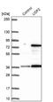 Ubiquitin Specific Peptidase 2 antibody, NBP1-86882, Novus Biologicals, Western Blot image 