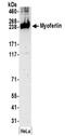 Myoferlin antibody, NBP2-32264, Novus Biologicals, Western Blot image 