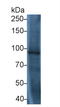 Toll Like Receptor 5 antibody, LS-C663206, Lifespan Biosciences, Western Blot image 