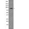 Pregnancy Specific Beta-1-Glycoprotein 1 antibody, PA5-64713, Invitrogen Antibodies, Western Blot image 