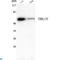 Transducin Beta Like 1 Y-Linked antibody, LS-C814130, Lifespan Biosciences, Western Blot image 