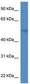 Sphingomyelin Phosphodiesterase Acid Like 3A antibody, TA340136, Origene, Western Blot image 