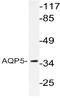 Aquaporin 5 antibody, AP20601PU-N, Origene, Western Blot image 