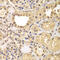 Aryl Hydrocarbon Receptor Nuclear Translocator 2 antibody, 23-373, ProSci, Immunohistochemistry frozen image 