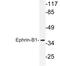 Ephrin B1 antibody, LS-C176509, Lifespan Biosciences, Western Blot image 