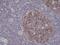 Aurora Kinase B antibody, NBP2-61493, Novus Biologicals, Immunohistochemistry paraffin image 