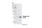 Cyclin Dependent Kinase 1 antibody, 4539S, Cell Signaling Technology, Western Blot image 