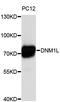 Dynamin 1 Like antibody, abx126887, Abbexa, Western Blot image 