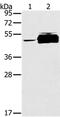 Tyrosine-protein phosphatase non-receptor type 20 antibody, PA5-50736, Invitrogen Antibodies, Western Blot image 