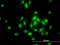TBC1 Domain Containing Kinase antibody, H00093627-M01, Novus Biologicals, Immunocytochemistry image 