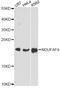 NADH:Ubiquinone Oxidoreductase Complex Assembly Factor 4 antibody, A14345, ABclonal Technology, Western Blot image 