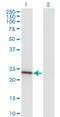 Mitochondrial Ribosome Recycling Factor antibody, H00092399-M11, Novus Biologicals, Western Blot image 