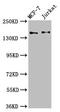Kinectin 1 antibody, CSB-PA773030LA01HU, Cusabio, Western Blot image 
