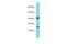 Trem-like transcript 4 protein antibody, A14128, Boster Biological Technology, Western Blot image 