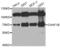 Chromatin Assembly Factor 1 Subunit B antibody, LS-C335645, Lifespan Biosciences, Western Blot image 