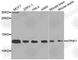 ATP Synthase Inhibitory Factor Subunit 1 antibody, A5099, ABclonal Technology, Western Blot image 