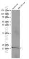 Mediator Complex Subunit 9 antibody, 27452-1-AP, Proteintech Group, Western Blot image 