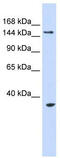 Ubiquitin Protein Ligase E3B antibody, TA330496, Origene, Western Blot image 