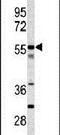 Carboxypeptidase N Subunit 2 antibody, PA5-14235, Invitrogen Antibodies, Western Blot image 