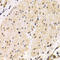 Transmembrane protease serine 2 antibody, A00666, Boster Biological Technology, Immunohistochemistry paraffin image 