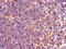 TXK Tyrosine Kinase antibody, CSB-PA025362LA01HU, Cusabio, Immunohistochemistry paraffin image 