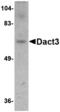 Dishevelled Binding Antagonist Of Beta Catenin 3 antibody, A11557, Boster Biological Technology, Western Blot image 