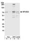 RNA Pseudouridine Synthase Domain Containing 2 antibody, A305-209A, Bethyl Labs, Western Blot image 