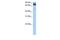 Adenosine Deaminase Domain Containing 2 antibody, GTX47218, GeneTex, Western Blot image 