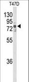 Non-receptor tyrosine-protein kinase TNK1 antibody, LS-C160085, Lifespan Biosciences, Western Blot image 