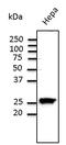 RAB11A, Member RAS Oncogene Family antibody, LS-C204239, Lifespan Biosciences, Western Blot image 