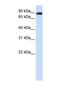 ADAM Metallopeptidase Domain 19 antibody, NBP1-69364, Novus Biologicals, Western Blot image 