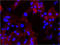 Integrin Subunit Alpha 6 antibody, LS-C41344, Lifespan Biosciences, Immunohistochemistry paraffin image 