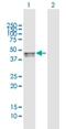 Sphingomyelin Phosphodiesterase Acid Like 3B antibody, H00027293-B01P, Novus Biologicals, Western Blot image 