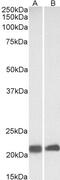 Caveolin 3 antibody, 46-992, ProSci, Western Blot image 