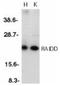 CASP2 And RIPK1 Domain Containing Adaptor With Death Domain antibody, NBP1-77061, Novus Biologicals, Western Blot image 
