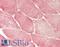 Cytochrome C Oxidase Subunit 4I1 antibody, LS-B14723, Lifespan Biosciences, Immunohistochemistry paraffin image 