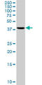 Ribonucleotide Reductase Regulatory Subunit M2 antibody, LS-B4409, Lifespan Biosciences, Western Blot image 