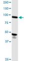 Activating Signal Cointegrator 1 Complex Subunit 2 antibody, H00084164-M07, Novus Biologicals, Western Blot image 