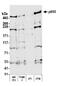 E3 ubiquitin-protein ligase UBR4 antibody, A302-278A, Bethyl Labs, Western Blot image 