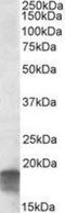 Succinate Dehydrogenase Complex Assembly Factor 1 antibody, NBP2-29339, Novus Biologicals, Western Blot image 