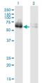 Zinc Finger Protein 35 antibody, H00007584-M03, Novus Biologicals, Western Blot image 