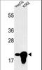 Bridging Integrator 3 antibody, LS-C156819, Lifespan Biosciences, Western Blot image 