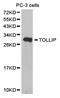 Toll Interacting Protein antibody, TA327336, Origene, Western Blot image 