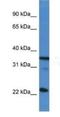 Serine And Arginine Rich Splicing Factor 2 antibody, NBP1-79886, Novus Biologicals, Western Blot image 