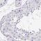 Zymogen Granule Protein 16B antibody, PA5-62803, Invitrogen Antibodies, Immunohistochemistry frozen image 