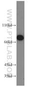 Procollagen-Lysine,2-Oxoglutarate 5-Dioxygenase 3 antibody, 11027-1-AP, Proteintech Group, Western Blot image 